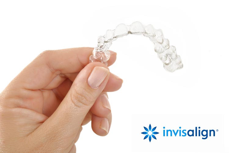 Invisalign